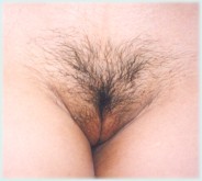 IMAGE2